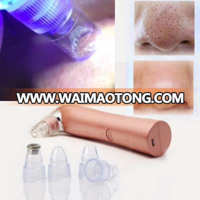 2017 trending products Hot sale facial care vacuum blackhead remover